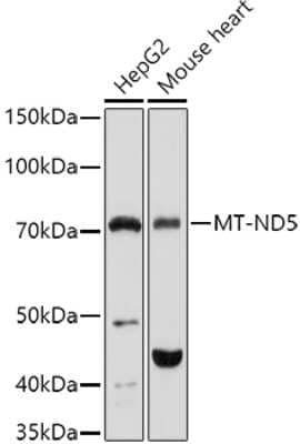 Western Blot: MT-ND5 Antibody [NBP3-05604] - Western blot analysis of extracts of various cell lines, using MT-ND5 antibody (NBP3-05604) at 1:1000 dilution. Secondary antibody: HRP Goat Anti-Rabbit IgG (H+L) at 1:10000 dilution. Lysates/proteins: 25ug per lane. Blocking buffer: 3% nonfat dry milk in TBST. Detection: ECL Basic Kit. Exposure time: 180s.